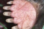 Hand of Scalopus aquaticus 